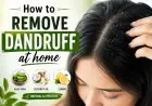 How to remove Dandruff at home