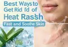 Best Ways to Get Rid of Heat Rash Fast and Soothe Skin