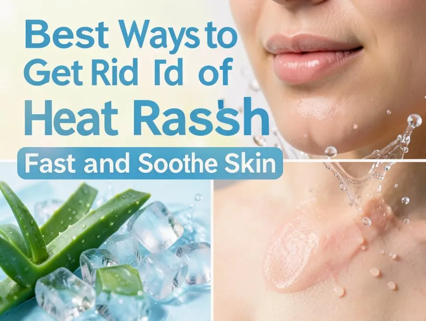Best Ways to Get Rid of Heat Rash Fast and Soothe Skin